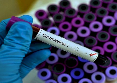 Saúde confirma primeiro caso da nova variante do coronavírus em MS