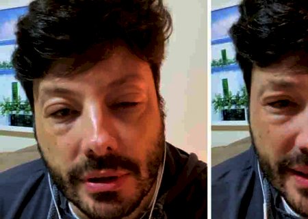 Danilo Gentili assusta fãs ao aparecer com rosto deformado: ‘Certeza da minha fé