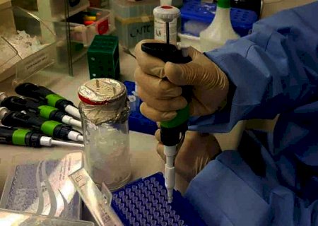 Saúde confirma 2 casos de reinfecção por covid em MS; um deles é de jovem de 19 anos