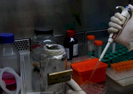 Covid-19: pesquisadores criam teste barato para unidades de saúde