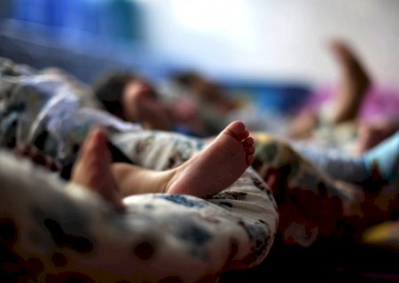Microcefalia causada por Zika na gravidez gera mais danos que por outros fatores, diz pesquisa