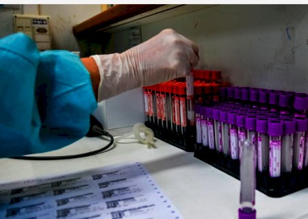 Prudente confirma primeiro caso de covid por variante Delta