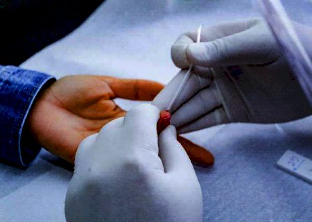 Covid-19: Brasil tem 21,8 milh&otilde;es de casos e mais de 608 mil mortes