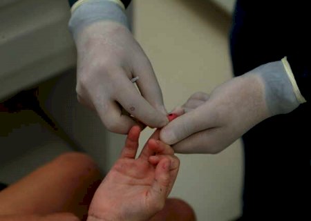 Covid-19: Brasil tem 10,3 mil casos e 284 mortes em 24 horas