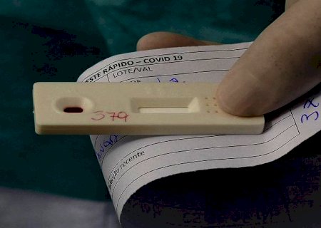 Como a variante Omicron pode afetar os testes de PCR existentes no mercado?