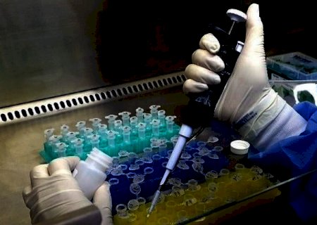 Taxa de positividade para Covid subiu para 33% em MS