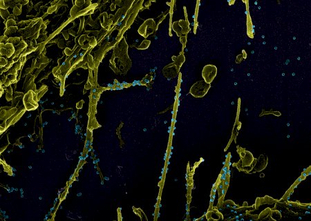 Subvariante da Ômicron é mais infecciosa que "original", diz estudo