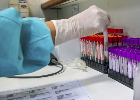 Campanha Fevereiro Laranja alerta sobre a leucemia