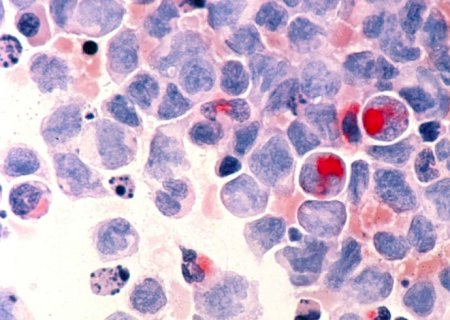 Anvisa aprova primeira terapia gênica contra câncer no Brasil