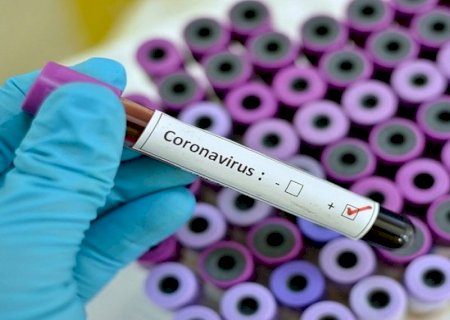 MS confirma 1.427 casos novos de Covid-19 nas últimas 24 horas
