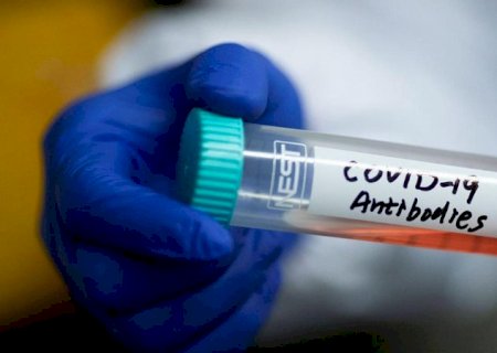 Brasil registra 518 mortes e 78.374 casos de covid nas últimas 24 horas