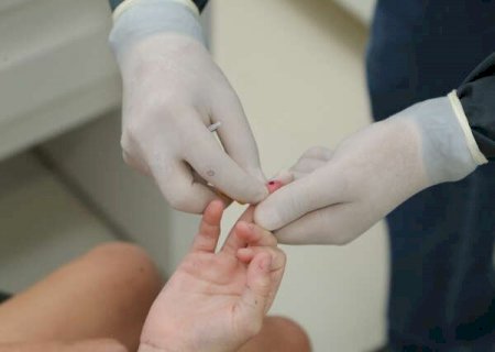 Covid-19: Brasil tem 30,5 milhões de casos e 664 mil óbitos