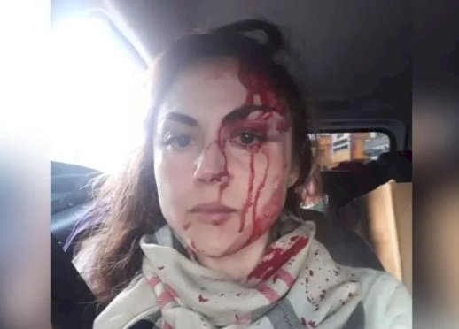 Procuradora-geral de cidade em SP é agredida por colega