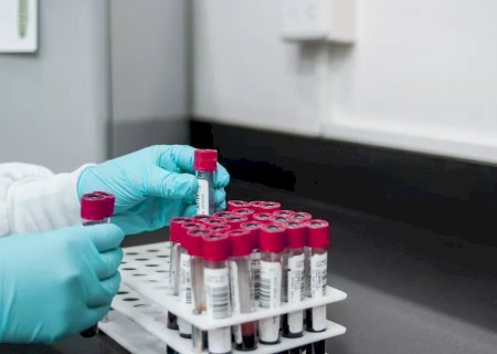 Novo exame de sangue identifica câncer de mama em 92% dos casos, eficácia superior à da mamografia