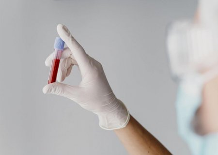 Conjunto de moléculas alteradas no sangue de pacientes com COVID-19 indica risco de complicações