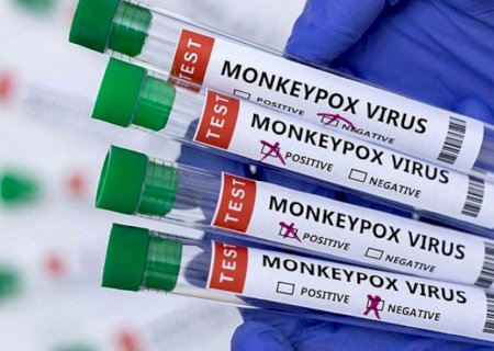 MS tem mais 9 casos suspeitos de variola dos macacos em um dia