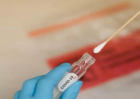 Brasil registra 6.809 casos de covid em 24h; média móvel é de 6 357