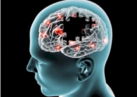 Idosos que pegaram Covid têm chance maior de desenvolver Alzheimer