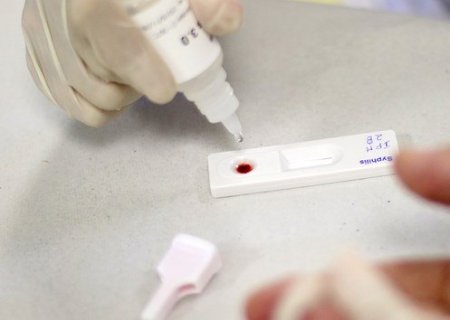 Sífilis: entenda o que é, qual a prevenção e o tratamento disponível no SUS
