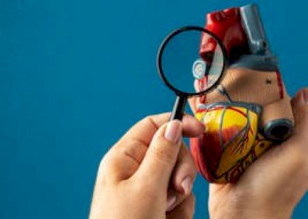 Colesterol 'bom' pode não ser tão útil quanto se imaginava para prever risco de infarto 