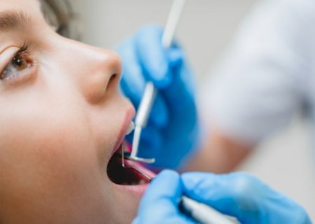 Cárie é uma das doenças crônicas não transmissíveis mais prevalentes no mundo
