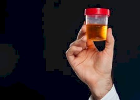 Exame de urina identifica doença de Alzheimer em estágio inicial