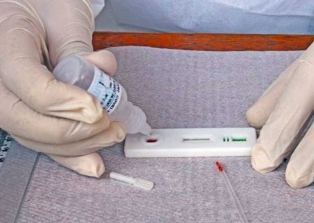 MS registra 330 novos casos de covid, com 5 mortes, em sete dias