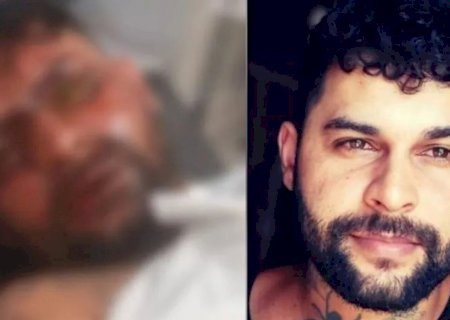 Tatuador que ficou cego com ácido perde olho após transplante
