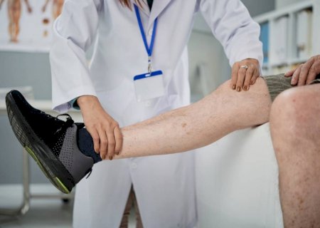 Trombose causa 165 internações diárias no Brasil, revelam médicos