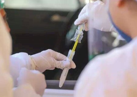 Perda de memória e falta de concentração podem indicar quadro de “covid longa”