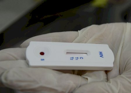 Saúde orienta farmácias sobre testes para HIV, sífilis e hepatites