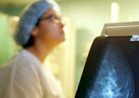 Por que a mamografia é tão vital contra o câncer de mama?