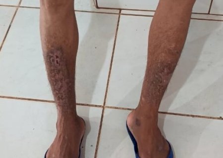 Após denúncia de cárcere, MP abre inquérito para investigar casa terapêutica
