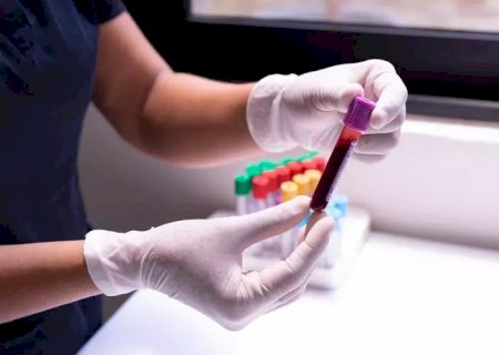 Já fez seu check-up do coração? Saiba o que ele deve contemplar | Letra de Médico