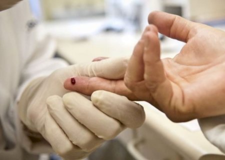 Novas infecções por HIV atingem menor nível global desde 1990