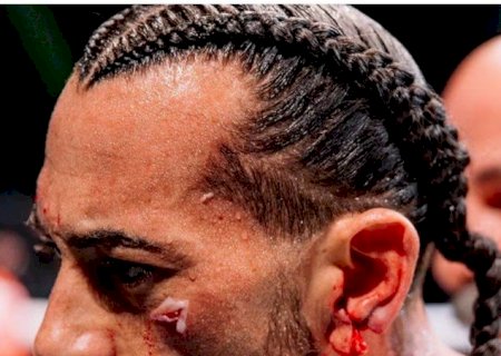 Imagem forte: lutador tem orelha 'decepada' em disputa no boxe sem luvas