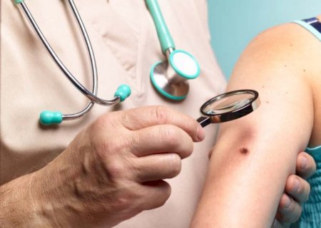 Como a IA pode auxiliar no diagnóstico precoce do câncer de pele? | Letra de Médico