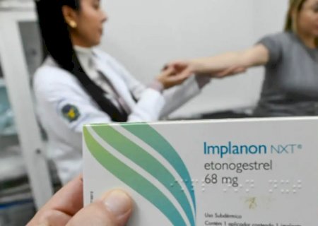 Implante contraceptivo deve ser ofertado por planos a partir deste mês
