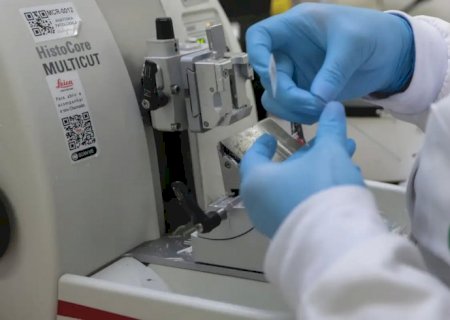 Cura de câncer de próstata pode chegar a até 98% 