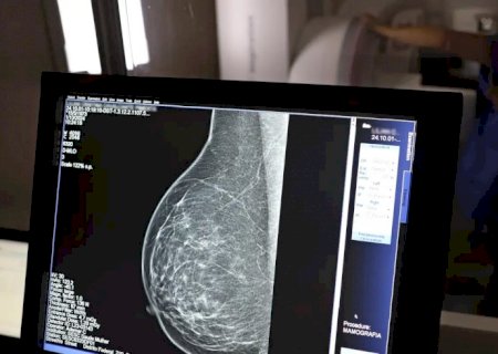 Falta de acesso a mamógrafos limita prevenção do câncer de mama