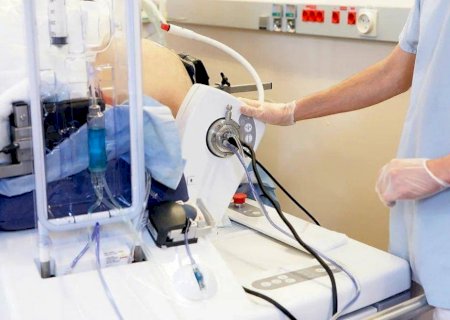 Como ultrassom inaugura nova era de tratamento de câncer sem cirurgias