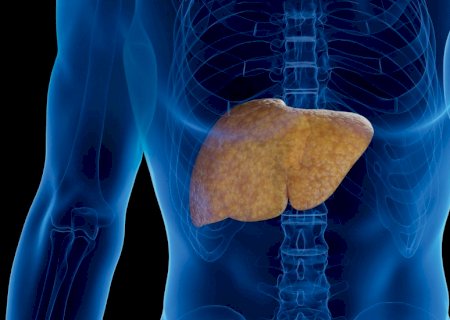 Nem o álcool nem os vírus por trás da hepatite: saiba qual é o maior inimigo do fígado