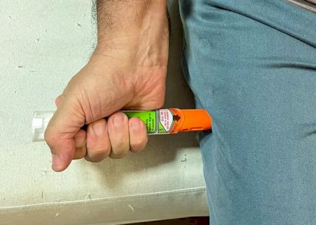 Brasil tem alta de anafilaxia e segue sem caneta de adrenalina