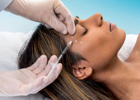 Anvisa alerta para risco de botulismo iatrogênico após aplicação de botox; entenda quadro e sinais