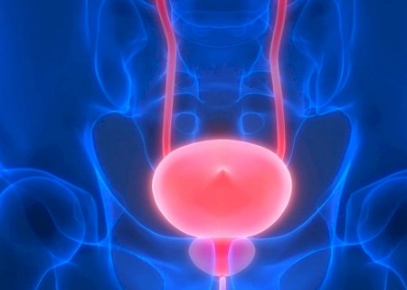 ANS inclui cirurgia robótica para câncer de próstata na cobertura obrigatória dos planos de saúde