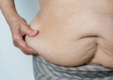 Gordura acumulada na barriga provoca danos cardíacos mais graves do que o peso total, aponta estudo