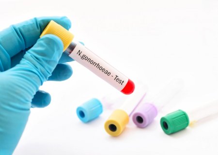 Novo antibiótico contra gonorreia é aprovado após décadas sem inovações