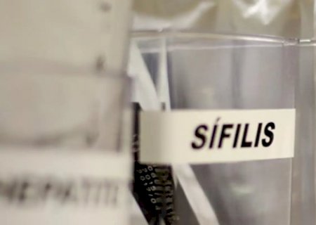 Sífilis continua em ritmo acelerado de crescimento no país