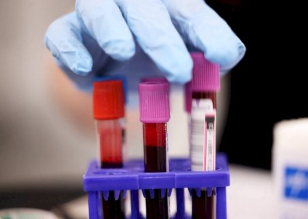 Sem respaldo, exames de sangue para detectar câncer precoce ganham espaço nos EUA