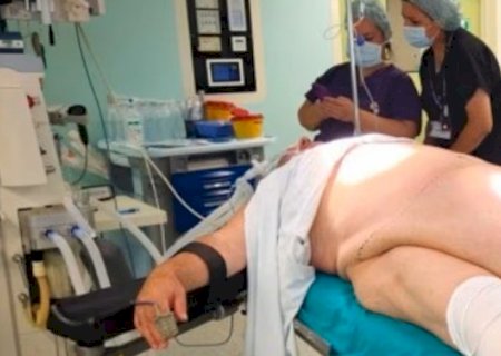 Homem intriga médicos com tumor gigante de 35 kg em formato de “avental”